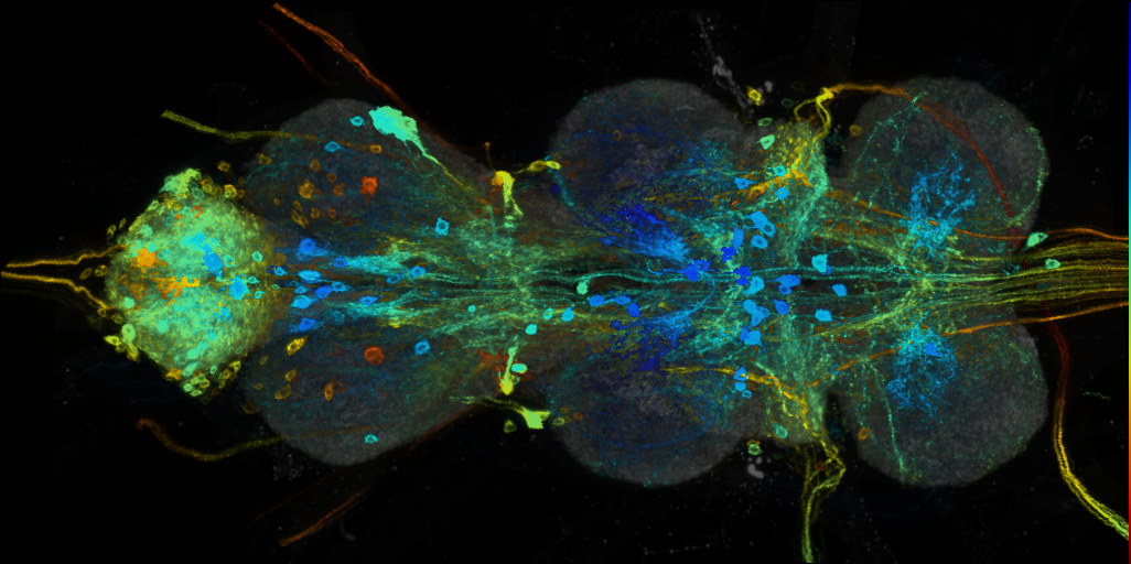 P{VT017251-GAL4} expression pattern