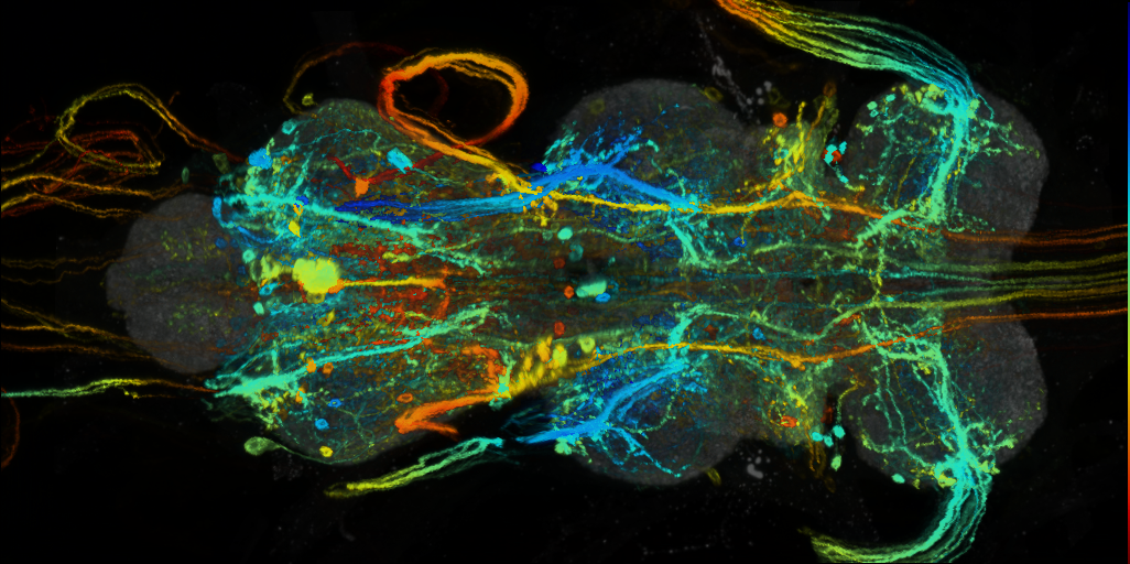 P{VT017657-GAL4} expression pattern