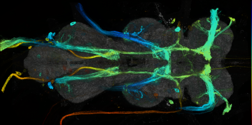 P{VT017745-GAL4} expression pattern