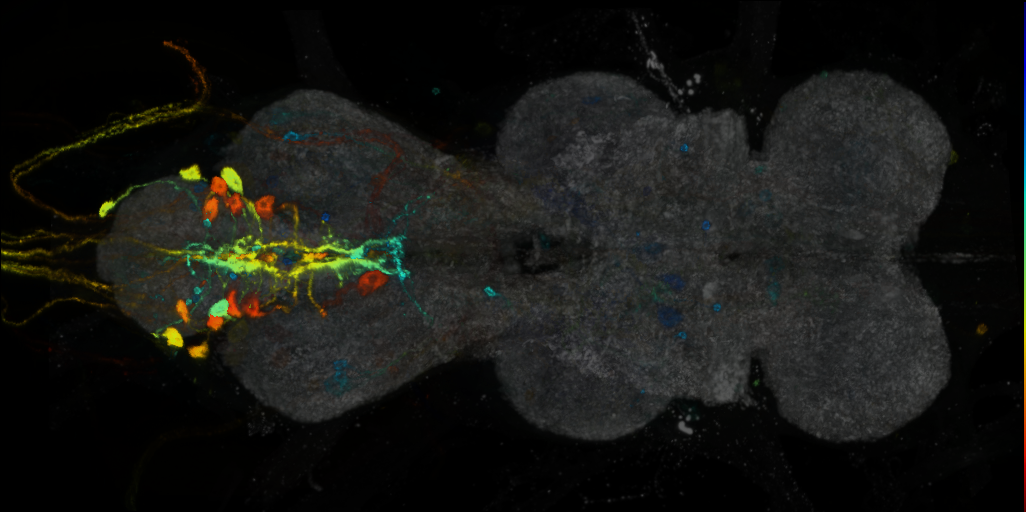 P{VT017862-GAL4} expression pattern