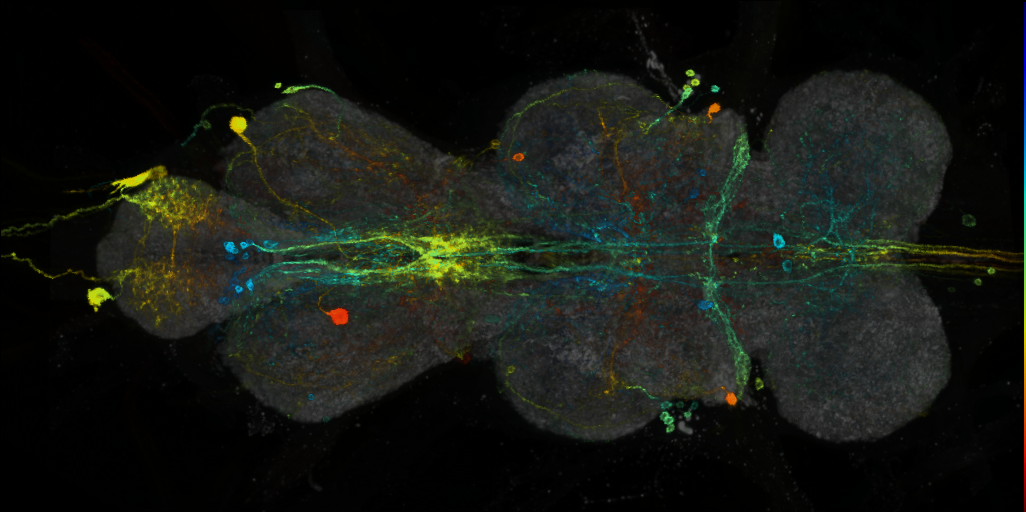 P{VT018453-GAL4} expression pattern