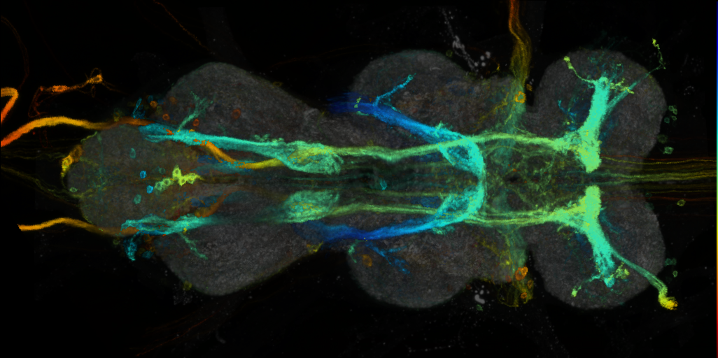 P{VT019317-GAL4} expression pattern