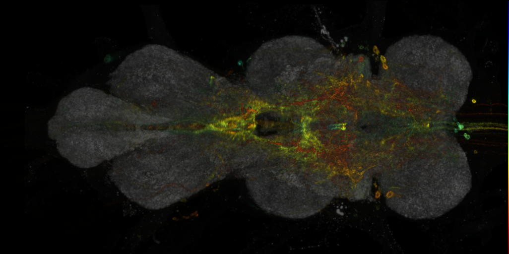 P{VT019398-GAL4} expression pattern