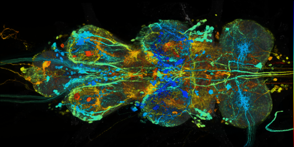 P{VT019422-GAL4} expression pattern