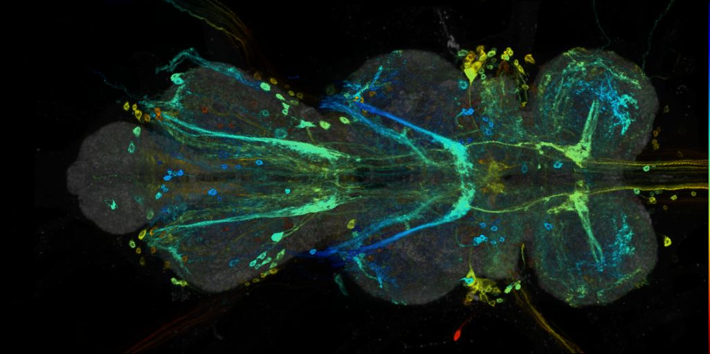 P{VT020824-GAL4} expression pattern