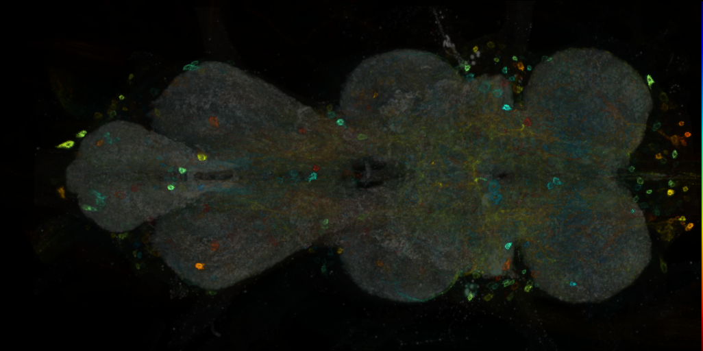 P{VT021015-GAL4} expression pattern