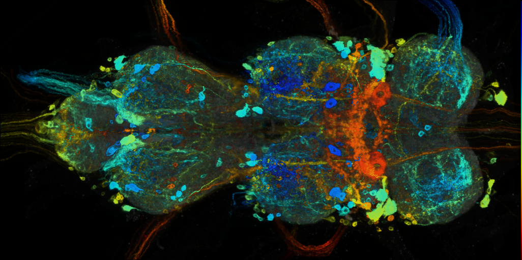 P{VT025493-GAL4} expression pattern