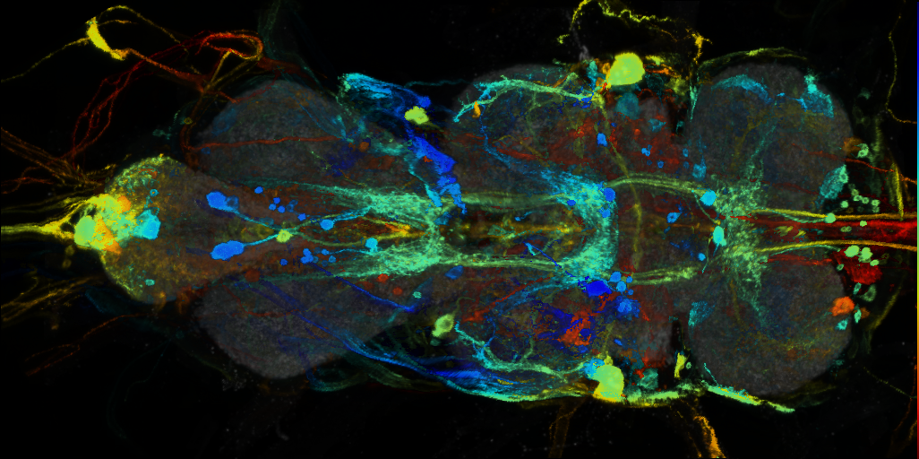 P{VT025976-GAL4} expression pattern