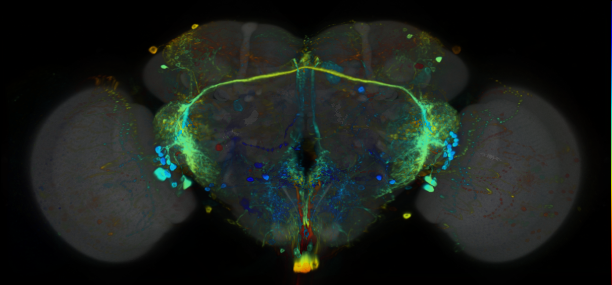 P{VT026034-GAL4} expression pattern