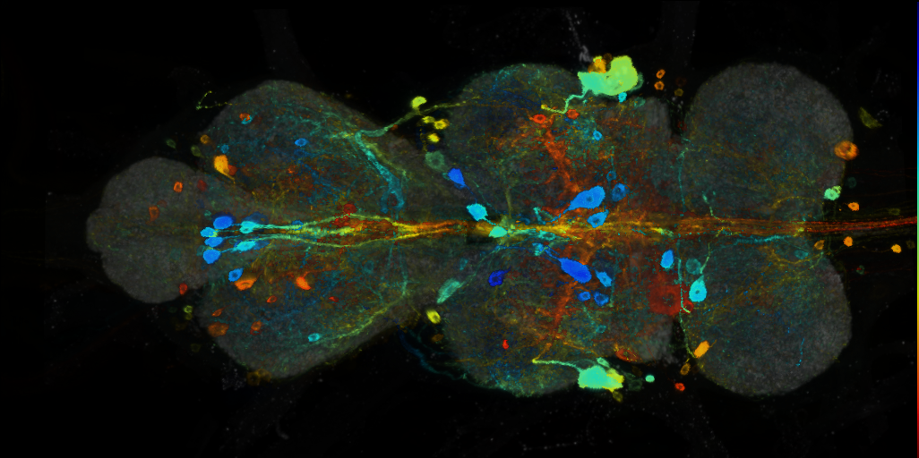 P{VT026034-GAL4} expression pattern