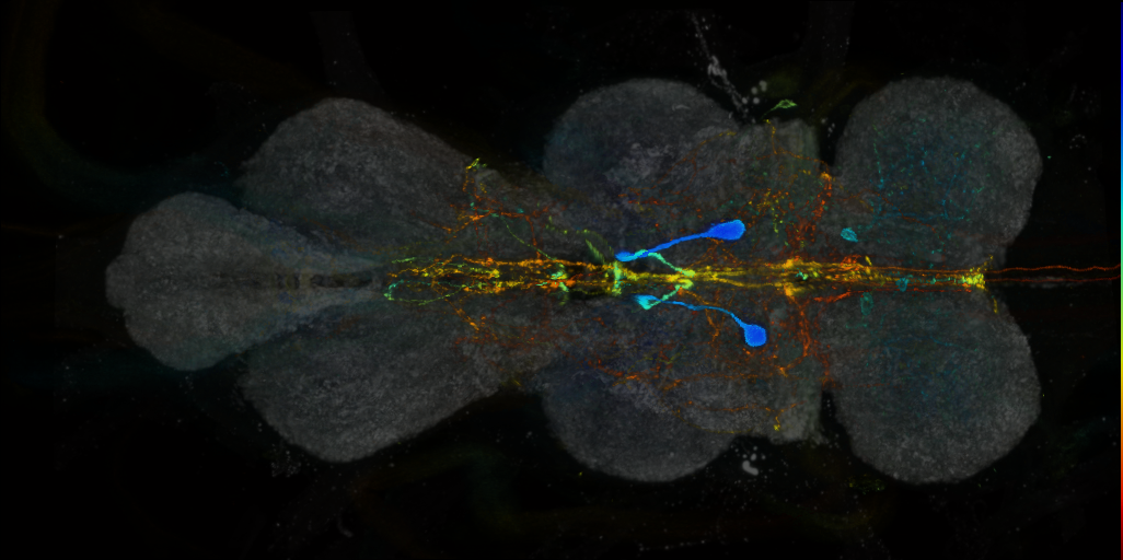 P{VT026523-GAL4} expression pattern