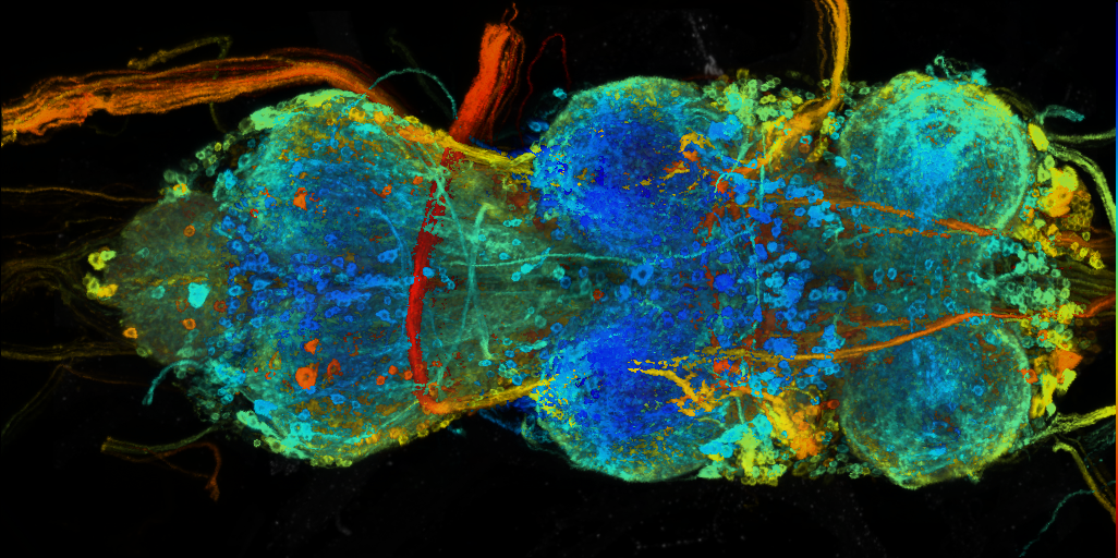 P{VT026658-GAL4} expression pattern