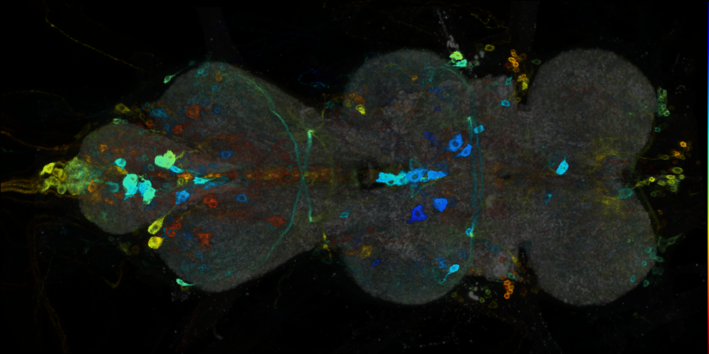 P{VT026663-GAL4} expression pattern