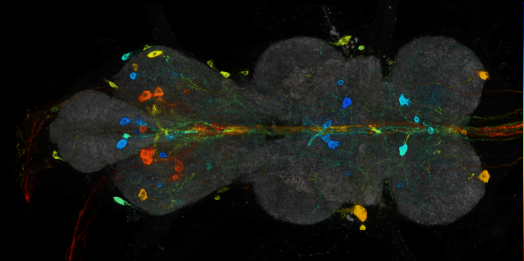 P{VT026993-GAL4} expression pattern
