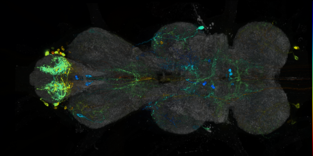 P{VT028144-GAL4} expression pattern