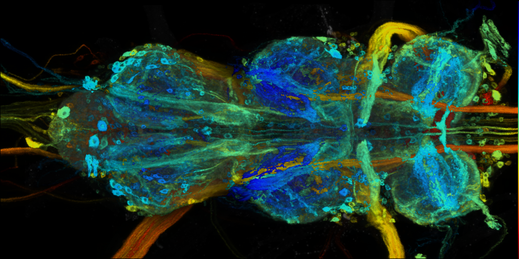 P{VT028151-GAL4} expression pattern