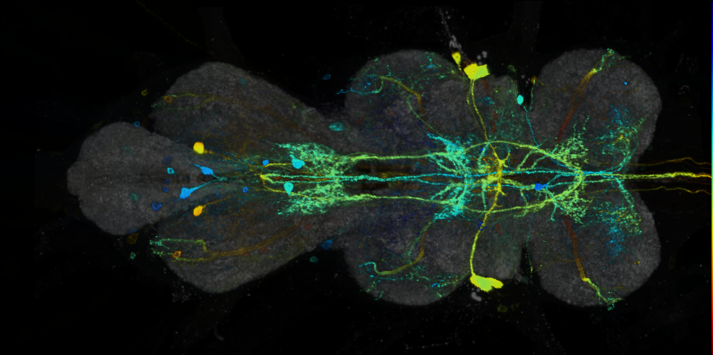 P{VT028606-GAL4} expression pattern