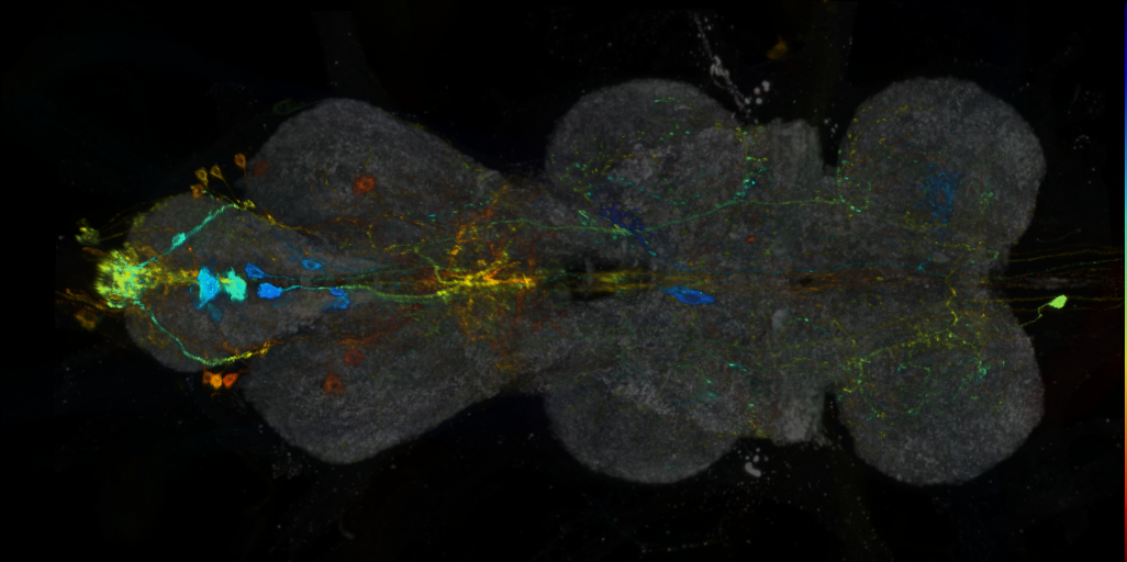 P{VT031392-GAL4} expression pattern