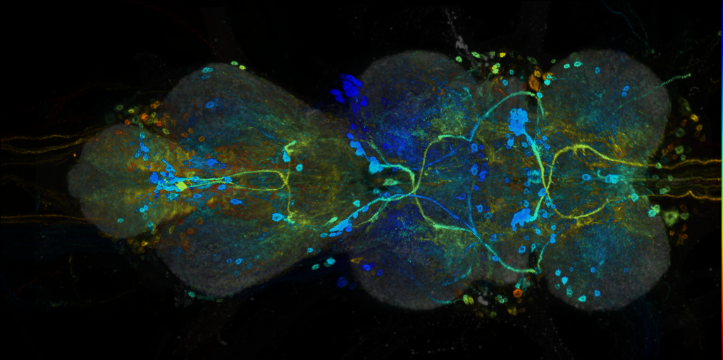 P{VT032336-GAL4} expression pattern