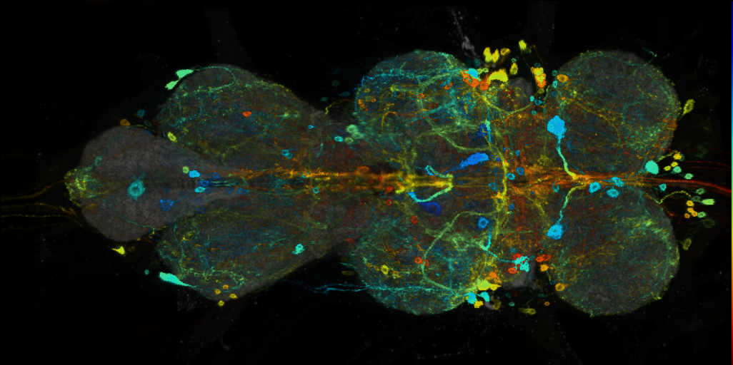 P{VT033616-GAL4} expression pattern