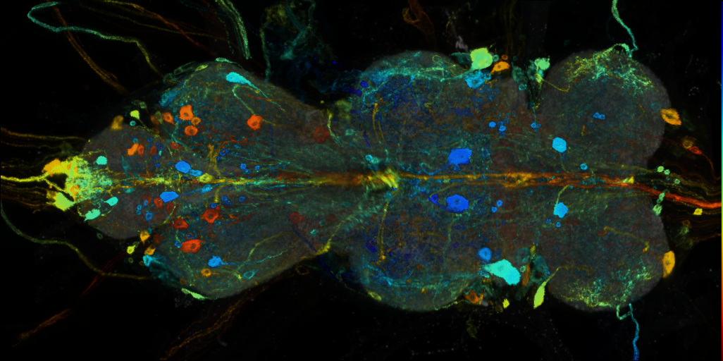 P{VT033641-GAL4} expression pattern
