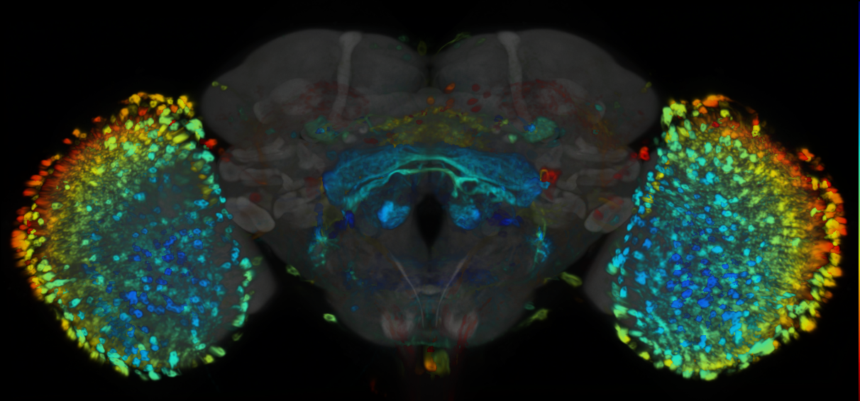 P{VT034615-GAL4} expression pattern