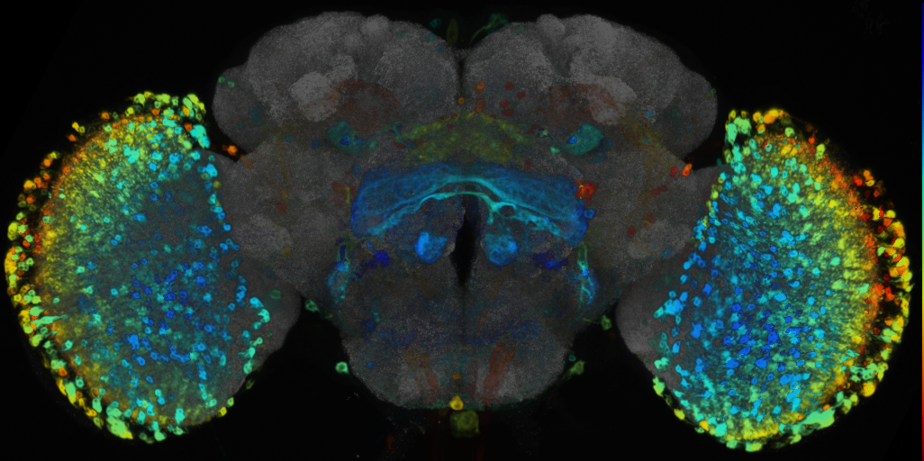 P{VT034615-GAL4} expression pattern