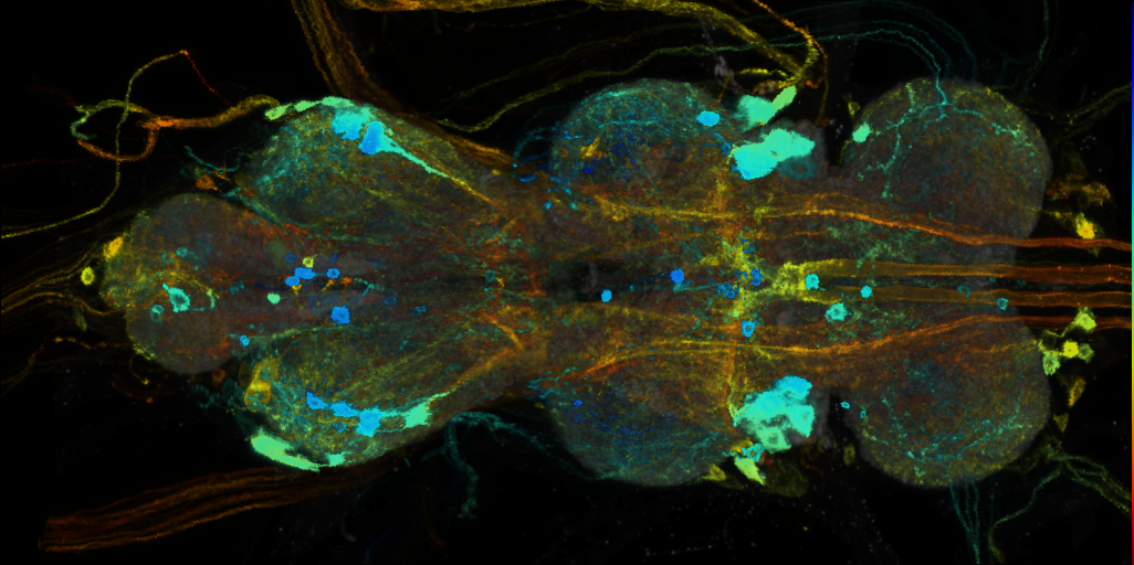 P{VT034615-GAL4} expression pattern