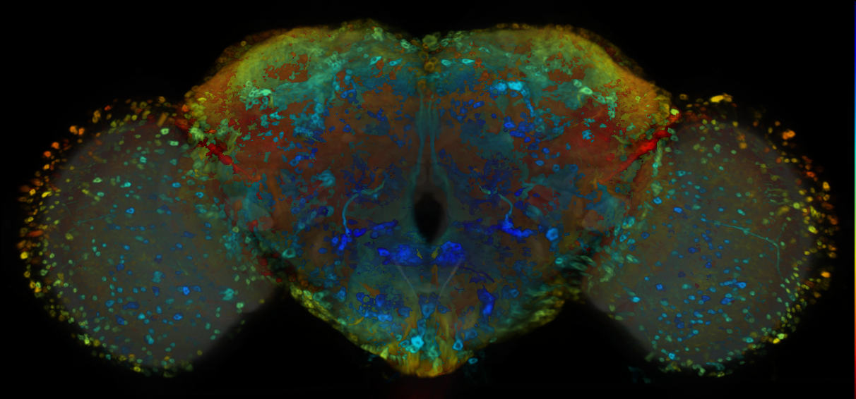 P{VT036876-GAL4} expression pattern