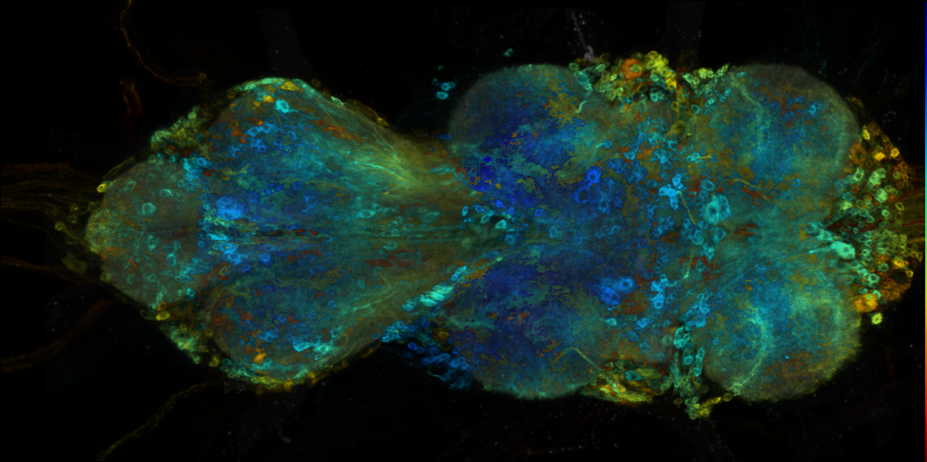 P{VT036876-GAL4} expression pattern