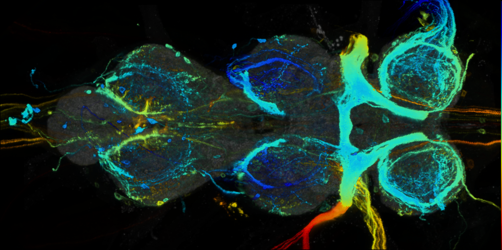 P{VT037493-GAL4} expression pattern