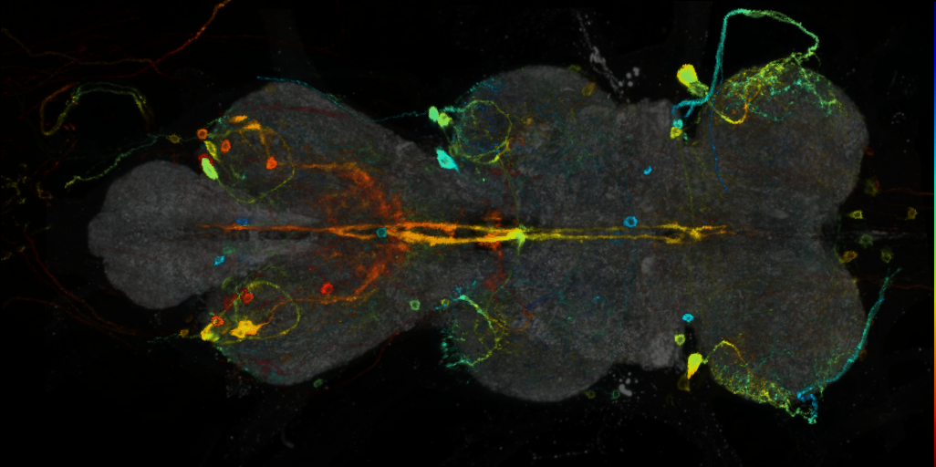 P{VT037867-GAL4} expression pattern