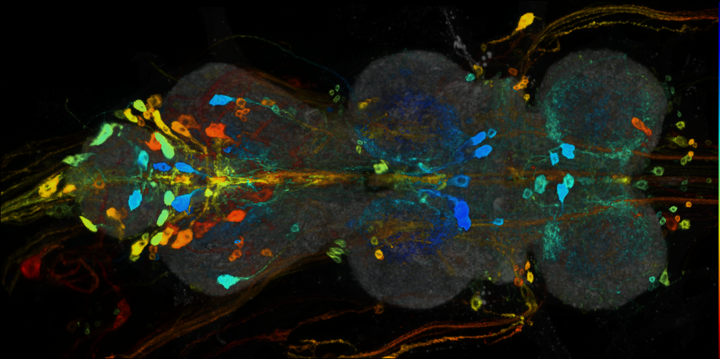 P{VT038815-GAL4} expression pattern