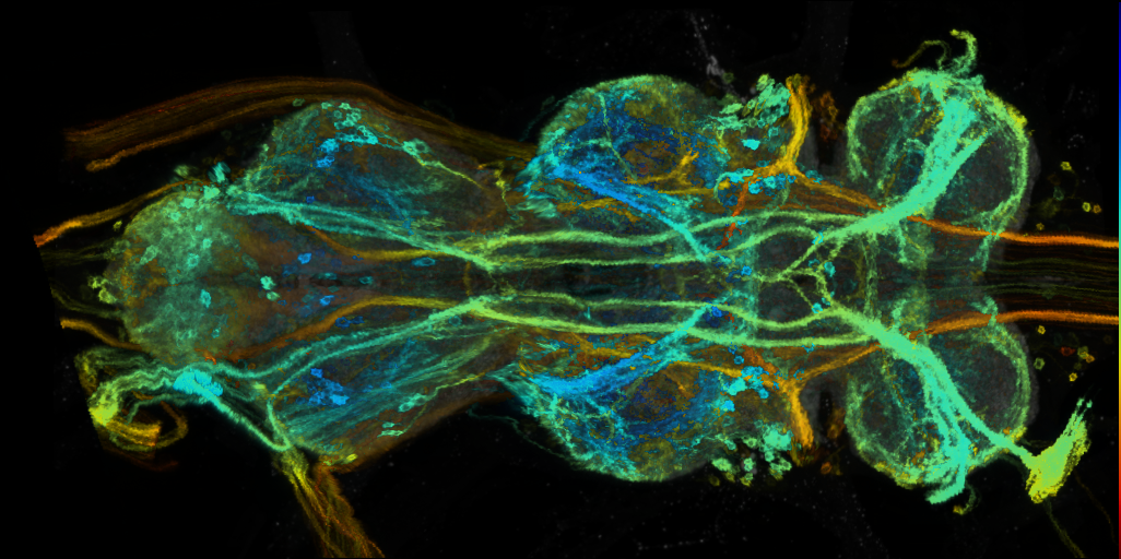 P{VT038823-GAL4} expression pattern