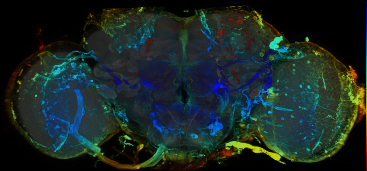 P{VT038885-GAL4} expression pattern