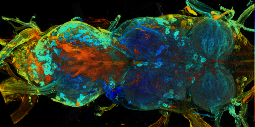 P{VT038885-GAL4} expression pattern