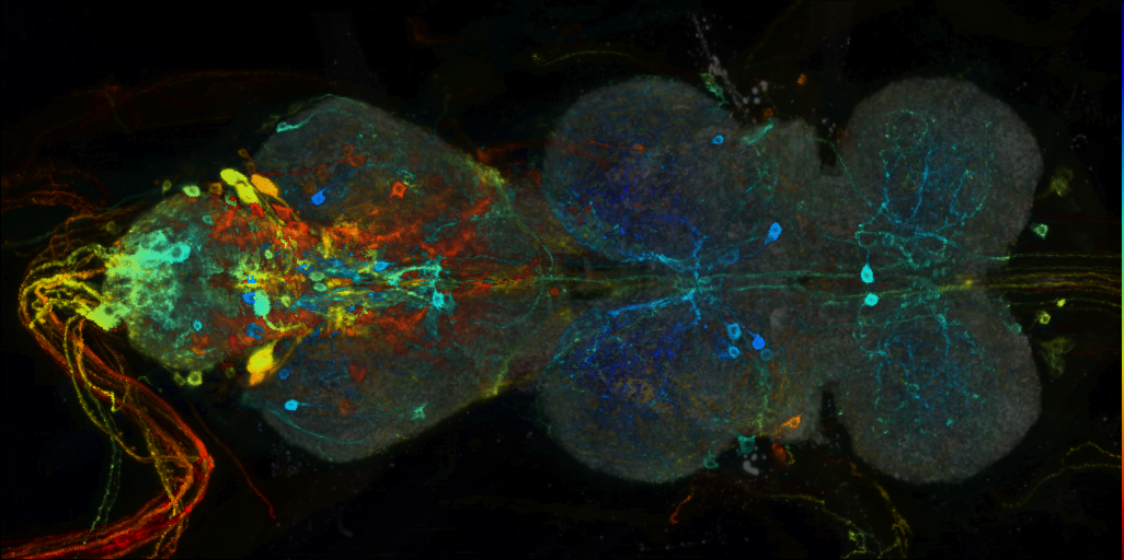 P{VT038964-GAL4} expression pattern