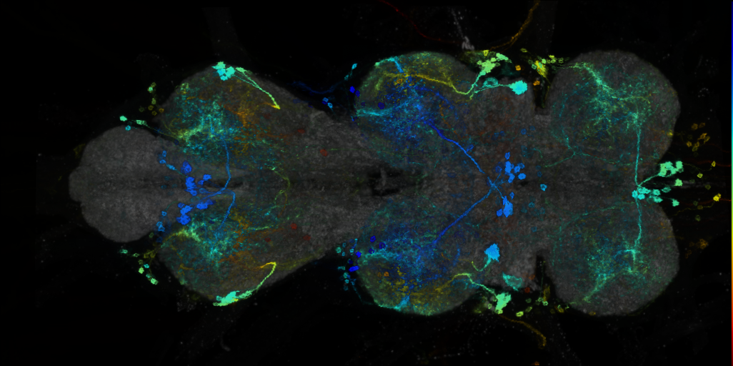 P{VT040360-GAL4} expression pattern