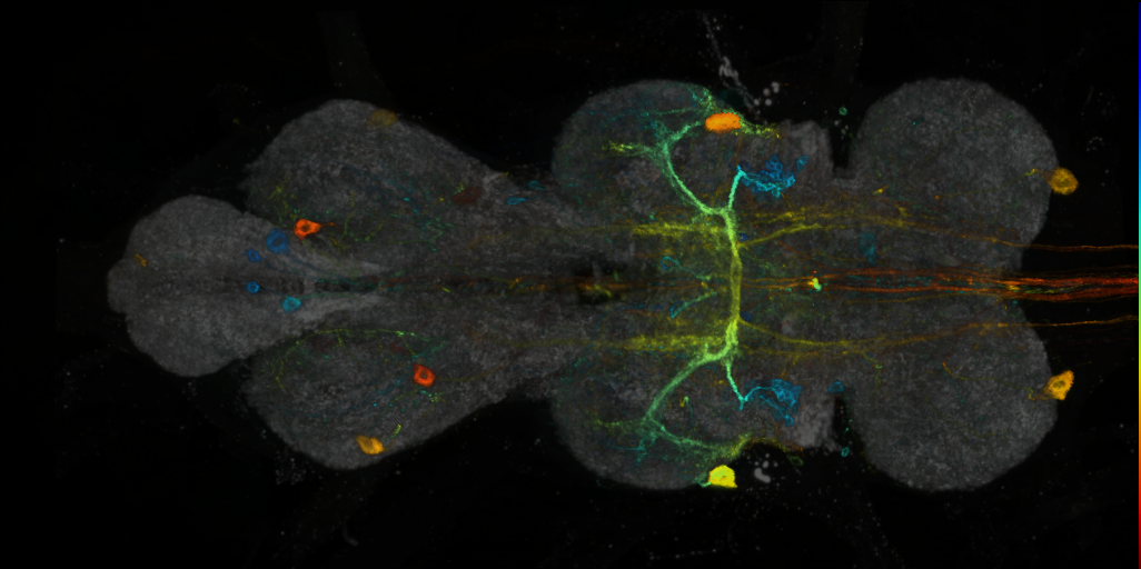 P{VT041300-GAL4} expression pattern