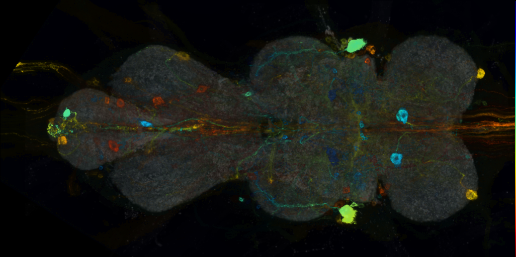 P{VT043086-GAL4} expression pattern