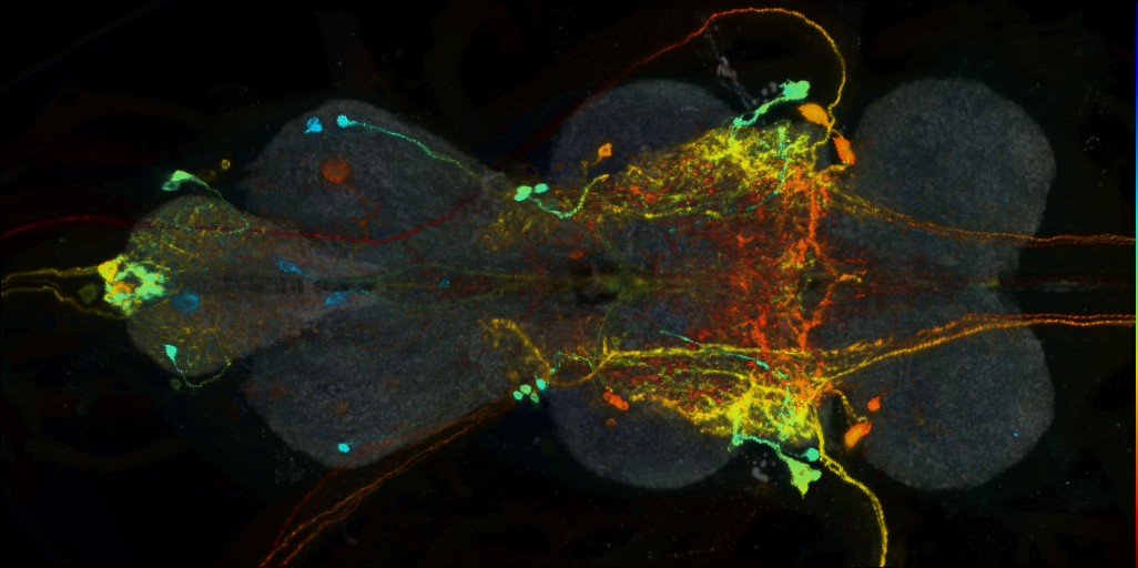 P{VT043294-GAL4} expression pattern