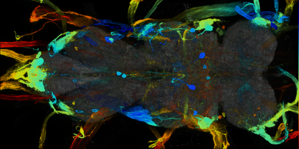 P{VT043400-GAL4} expression pattern