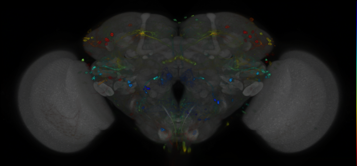 P{VT044179-GAL4} expression pattern