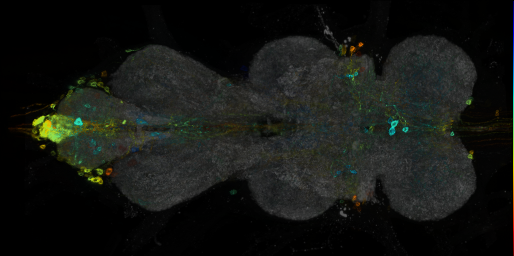 P{VT044179-GAL4} expression pattern