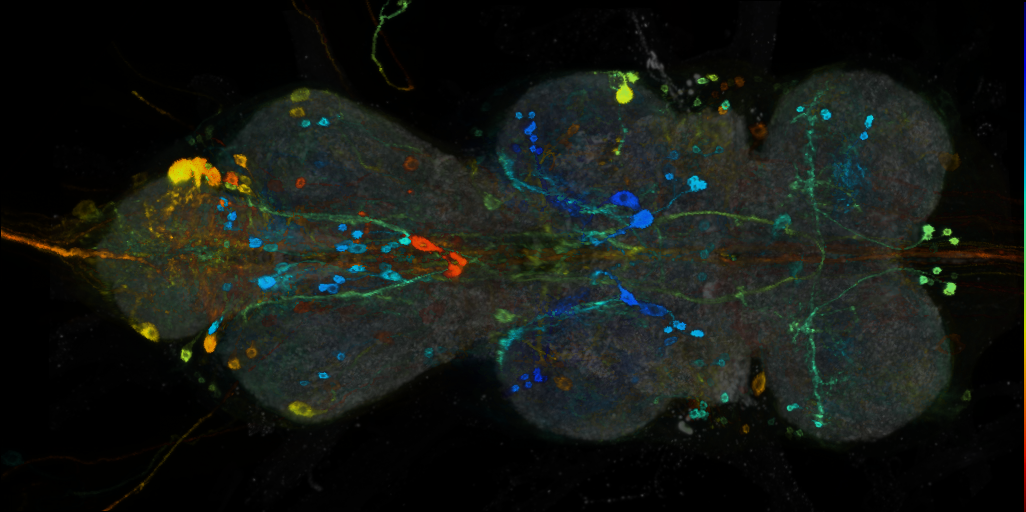 P{VT044330-GAL4} expression pattern