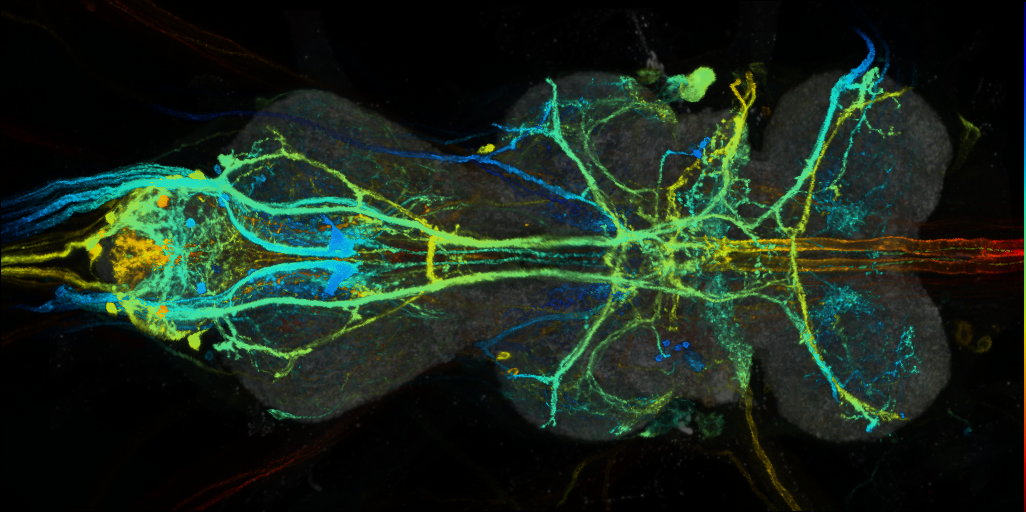 P{VT044843-GAL4} expression pattern