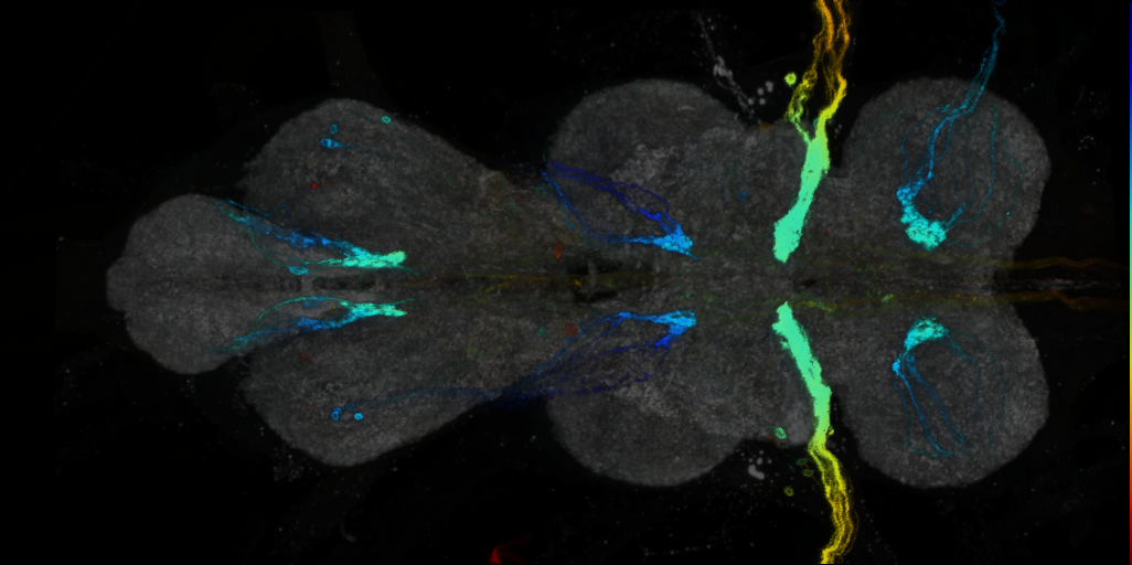 P{VT045975-GAL4} expression pattern