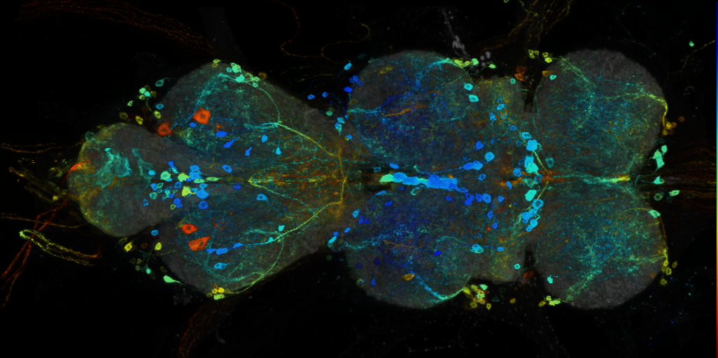 P{VT046809-GAL4} expression pattern
