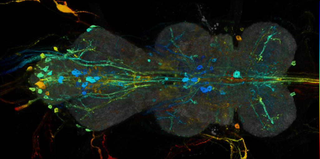 P{VT046821-GAL4} expression pattern