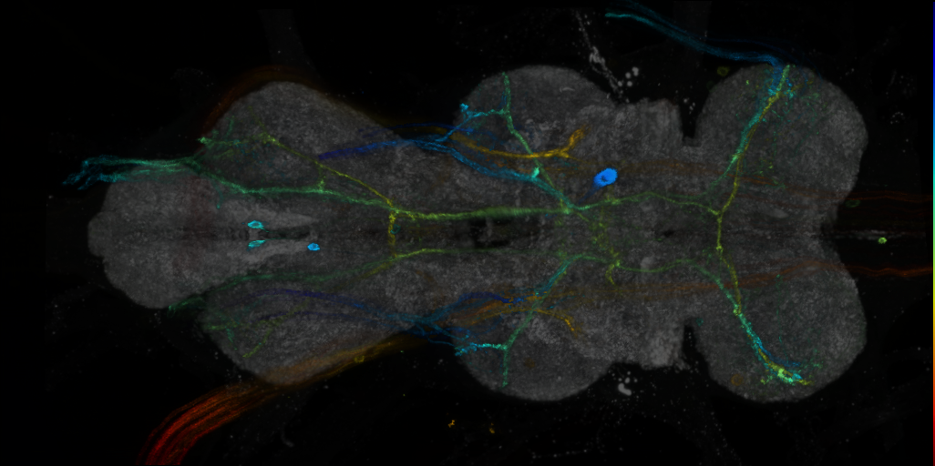 P{VT047170-GAL4} expression pattern